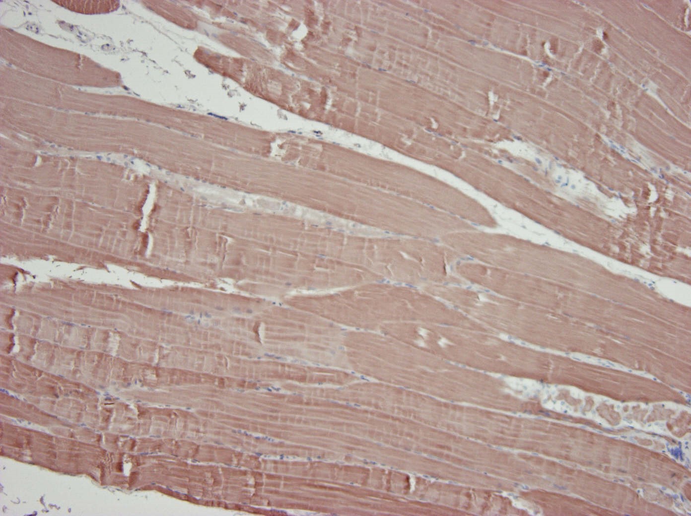 Figure 2. Formalin fixed, paraffin embedded human skeletal muscle tissue immunostained for alpha skeletal actin using MUB0108P (clone 3B3) at a 100x dilution. Note the strong staining of skeletal muscle cells and no reactivity in the surrounding connective tissue.